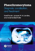 Télécharger le livre :  Pheochromocytoma