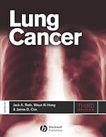 Télécharger le livre :  Lung Cancer