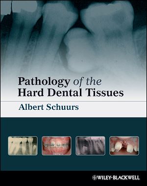 Téléchargez le livre :  Pathology of the Hard Dental Tissues