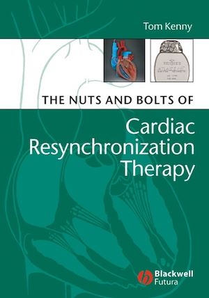Download the eBook: The Nuts and Bolts of Cardiac Resynchronization Therapy