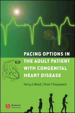 Téléchargez le livre :  Pacing Options in the Adult Patient with Congenital Heart Disease