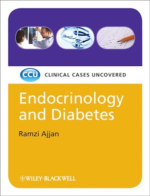 Téléchargez le livre :  Endocrinology and Diabetes, eTextbook