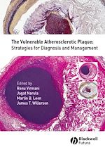 Télécharger le livre :  The Vulnerable Atherosclerotic Plaque