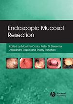 Télécharger le livre :  Endoscopic Mucosal Resection
