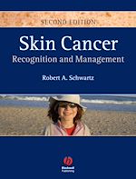 Télécharger le livre :  Skin Cancer