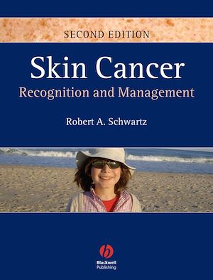 Téléchargez le livre :  Skin Cancer