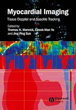 Télécharger le livre :  Myocardial Imaging