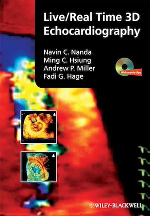 Download the eBook: Live/Real Time 3D Echocardiography