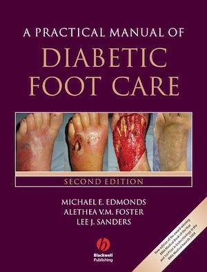 Téléchargez le livre :  A Practical Manual of Diabetic Foot Care