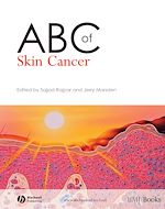 Télécharger le livre :  ABC of Skin Cancer
