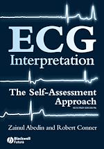 Télécharger le livre :  ECG Interpretation