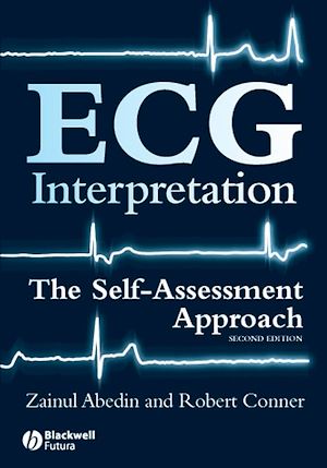 Téléchargez le livre :  ECG Interpretation