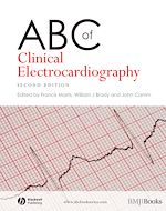 Télécharger le livre :  ABC of Clinical Electrocardiography