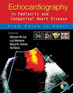 Télécharger le livre :  Echocardiography in Pediatric and Congenital Heart Disease