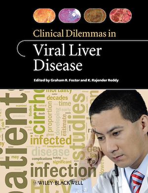 Téléchargez le livre :  Clinical Dilemmas in Viral Liver Disease