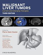 Télécharger le livre :  Malignant Liver Tumors