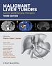 Télécharger le livre :  Malignant Liver Tumors