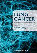 Télécharger le livre :  Lung Cancer