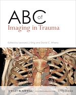 Télécharger le livre :  ABC of Imaging in Trauma