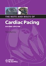 Download this eBook The Nuts and Bolts of Cardiac Pacing
