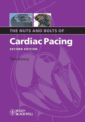 Download the eBook: The Nuts and Bolts of Cardiac Pacing
