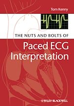 Download this eBook The Nuts and bolts of Paced ECG Interpretation