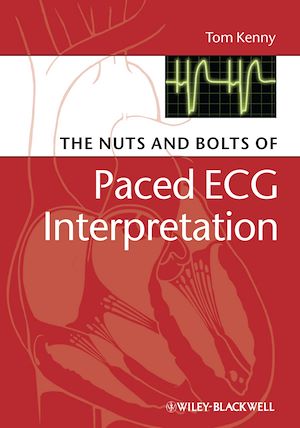 Download the eBook: The Nuts and bolts of Paced ECG Interpretation