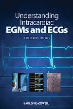 Download this eBook Understanding Intracardiac EGMs and ECGs
