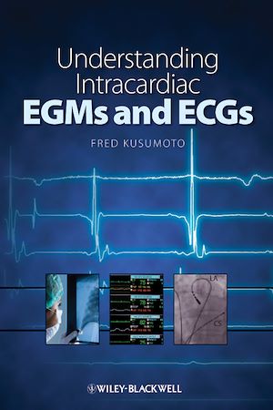 Download the eBook: Understanding Intracardiac EGMs and ECGs