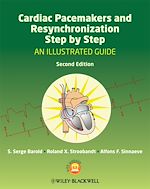 Download this eBook Cardiac Pacemakers and Resynchronization Step by Step