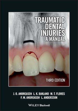 Téléchargez le livre :  Traumatic Dental Injuries
