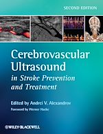 Download this eBook Cerebrovascular Ultrasound in Stroke Prevention and Treatment