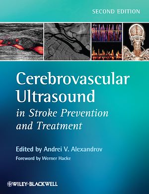 Download the eBook: Cerebrovascular Ultrasound in Stroke Prevention and Treatment