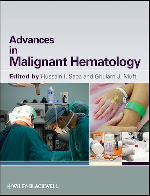 Download the eBook: Advances in Malignant Hematology