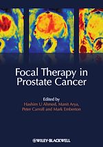 Télécharger le livre :  Focal Therapy in Prostate Cancer
