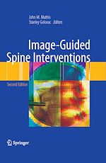 Télécharger le livre :  Image-Guided Spine Interventions