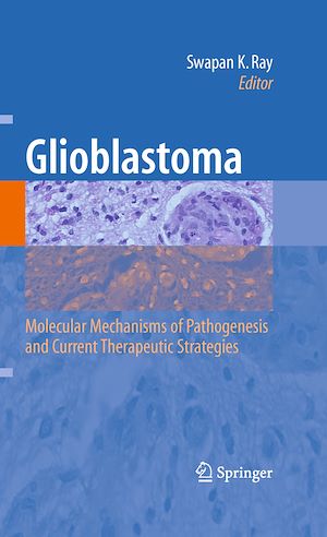 Téléchargez le livre :  Glioblastoma:
