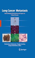 Télécharger le livre :  Lung Cancer Metastasis
