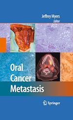 Télécharger le livre :  Oral Cancer Metastasis