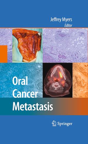 Téléchargez le livre :  Oral Cancer Metastasis