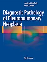 Télécharger le livre :  Diagnostic Pathology of Pleuropulmonary Neoplasia