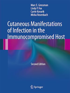Téléchargez le livre :  Cutaneous Manifestations of Infection in the Immunocompromised Host