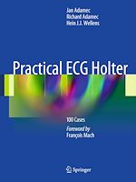 Télécharger le livre :  Practical ECG Holter