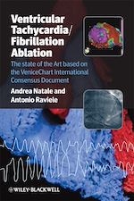 Télécharger le livre :  Ventricular Tachycardia / Fibrillation Ablation