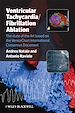 Télécharger le livre :  Ventricular Tachycardia / Fibrillation Ablation