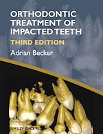 Télécharger le livre :  Orthodontic Treatment of Impacted Teeth