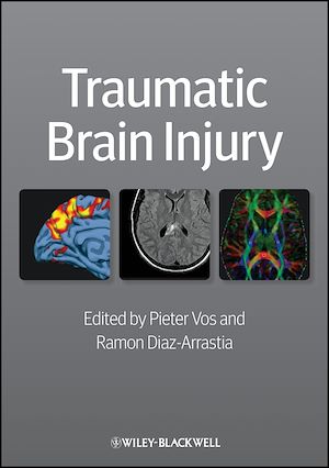 Download the eBook: Traumatic Brain Injury