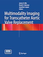 Télécharger le livre :  Multimodality Imaging for Transcatheter Aortic Valve Replacement