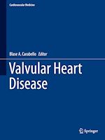 Télécharger le livre :  Valvular Heart Disease
