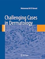 Télécharger le livre :  Challenging Cases in Dermatology